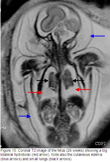 fig10