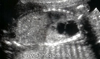 fig10