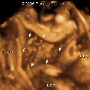 fig10