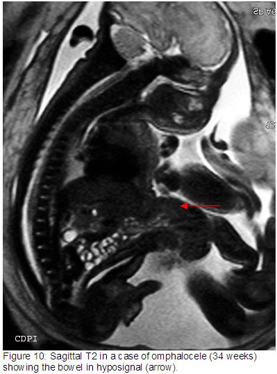fig10