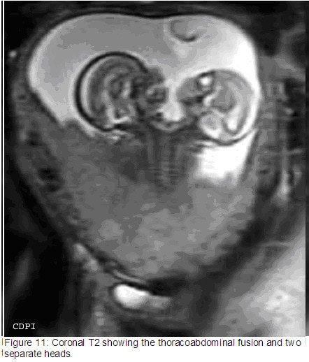 fig11