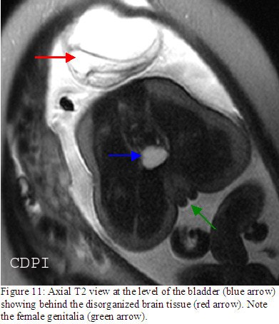 fig11