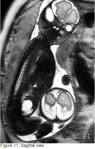 fig11