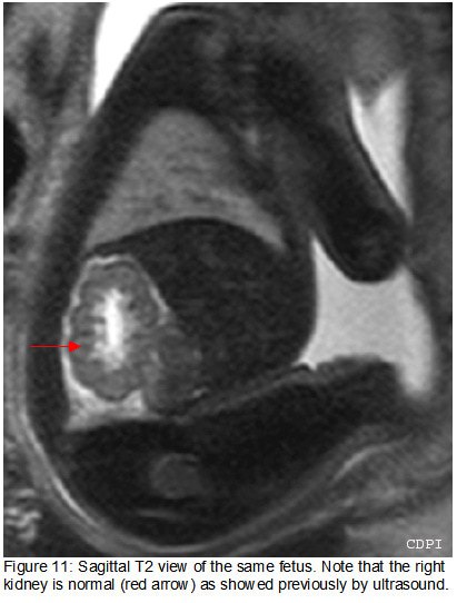 fig11