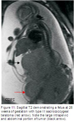 fig11