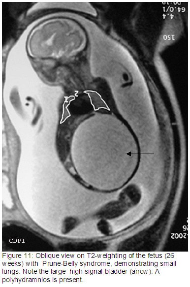 fig11