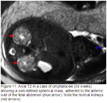 fig11