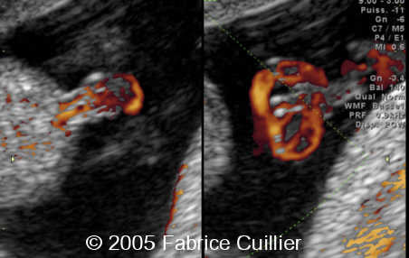 fig11