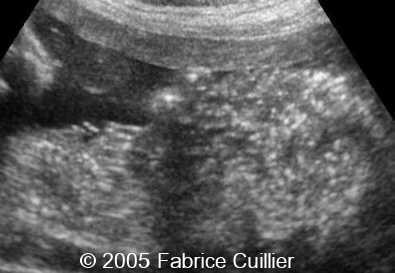 fig11