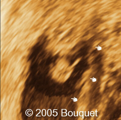 Fig11