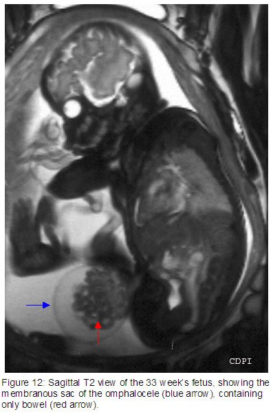fig12