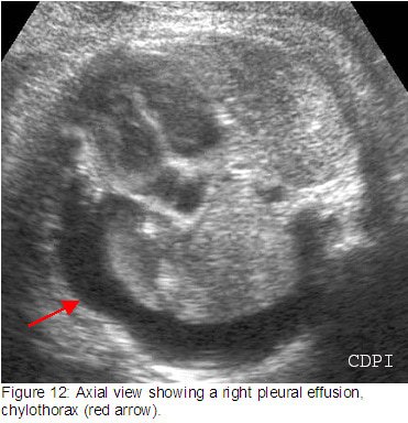 fig12
