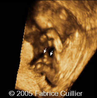 fig12