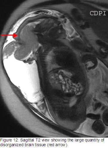 fig12