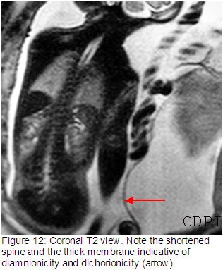 fig12