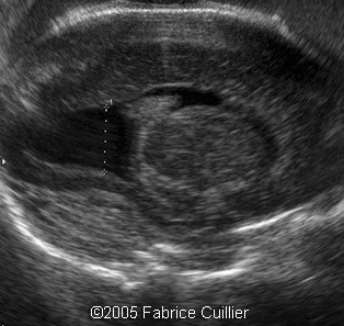fig12.