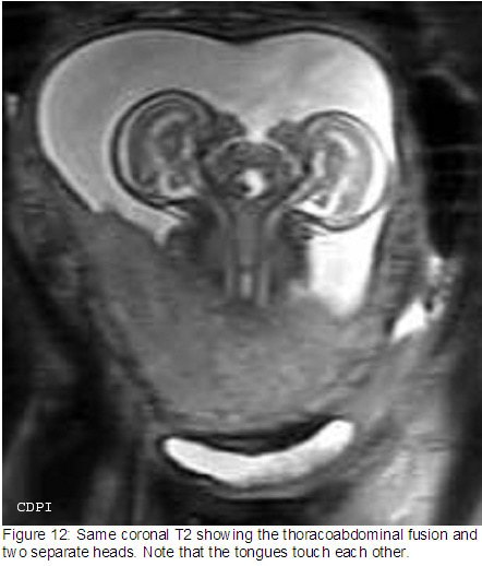 fig12
