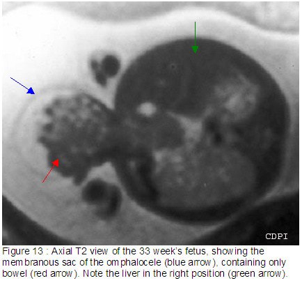 fig13