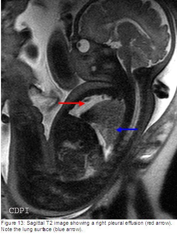 fig13