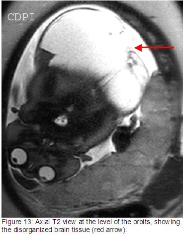 fig13