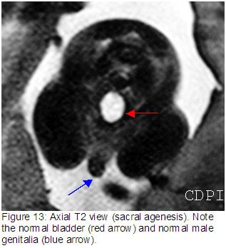 fig13