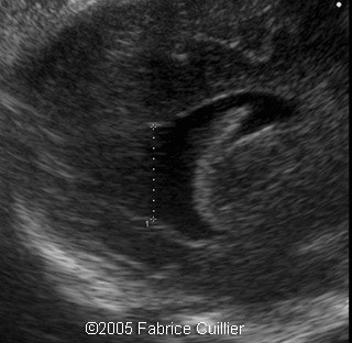 fig13