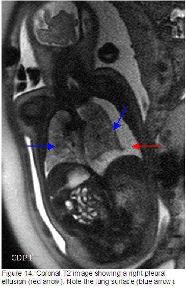 fig14