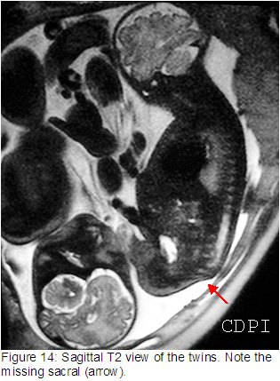 fig14