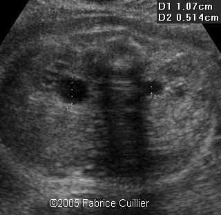 fig14.