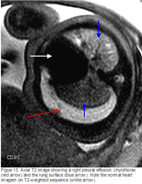 fig15