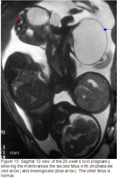fig15