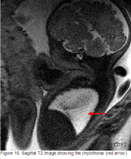 fig16