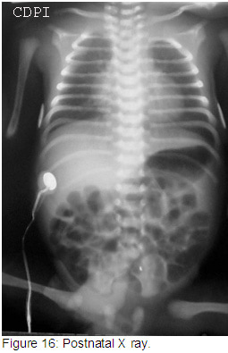 fig16