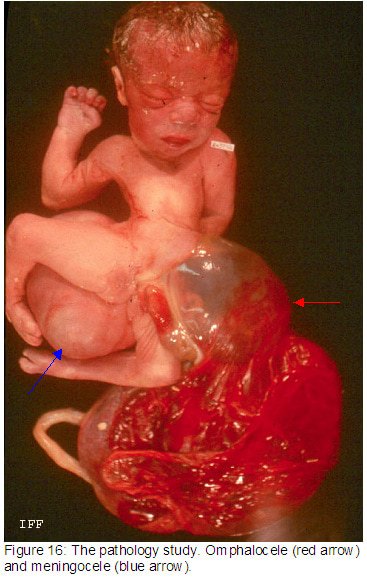 fig16