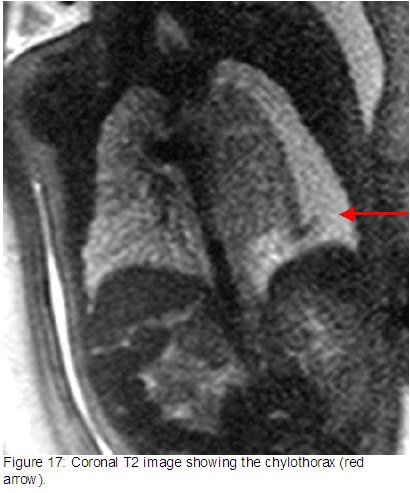 fig17