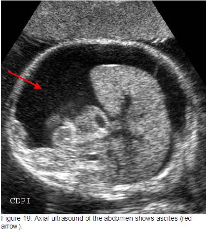 fig19