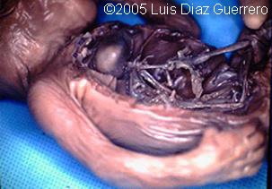 fig2_fetus