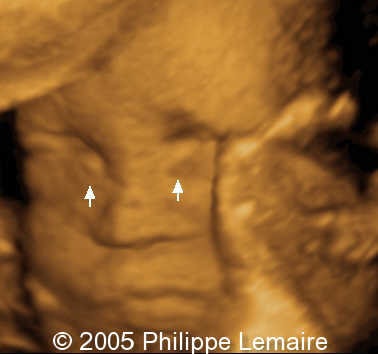 fig2