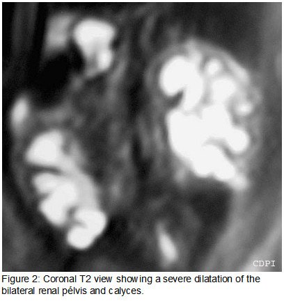 fig2