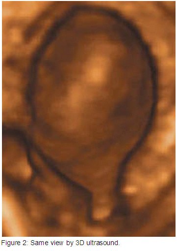 fig2