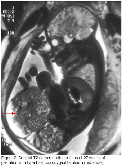 fig2