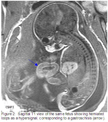 fig2