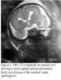 fig2