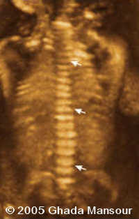 fig2