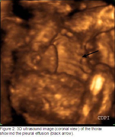 fig2
