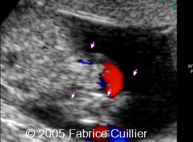 fig2