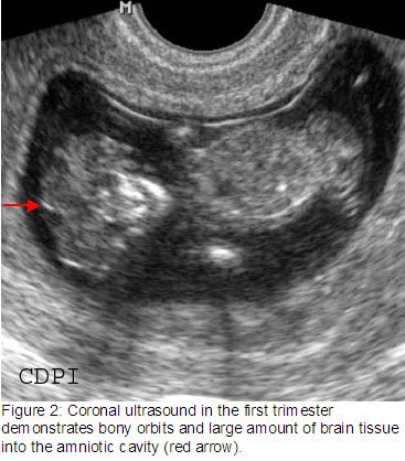 fig2