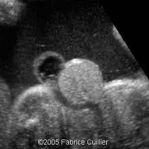 fig2