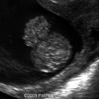 fig2