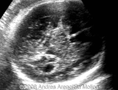 Fig2